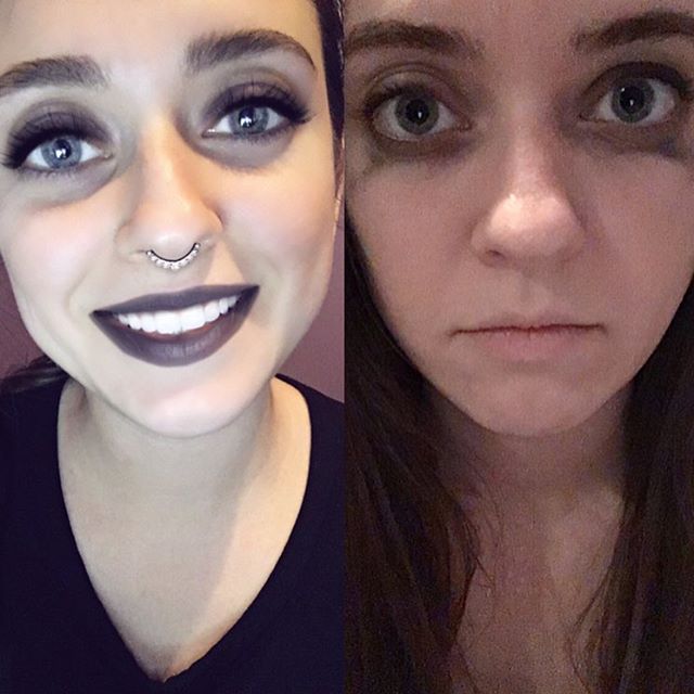 Antes e depois com ansiedade