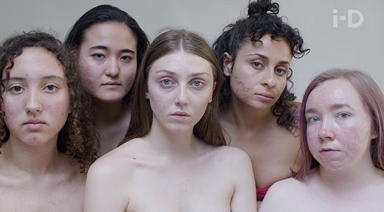 Movimento #FreeThePimple estimula mulheres com acne a se aceitarem