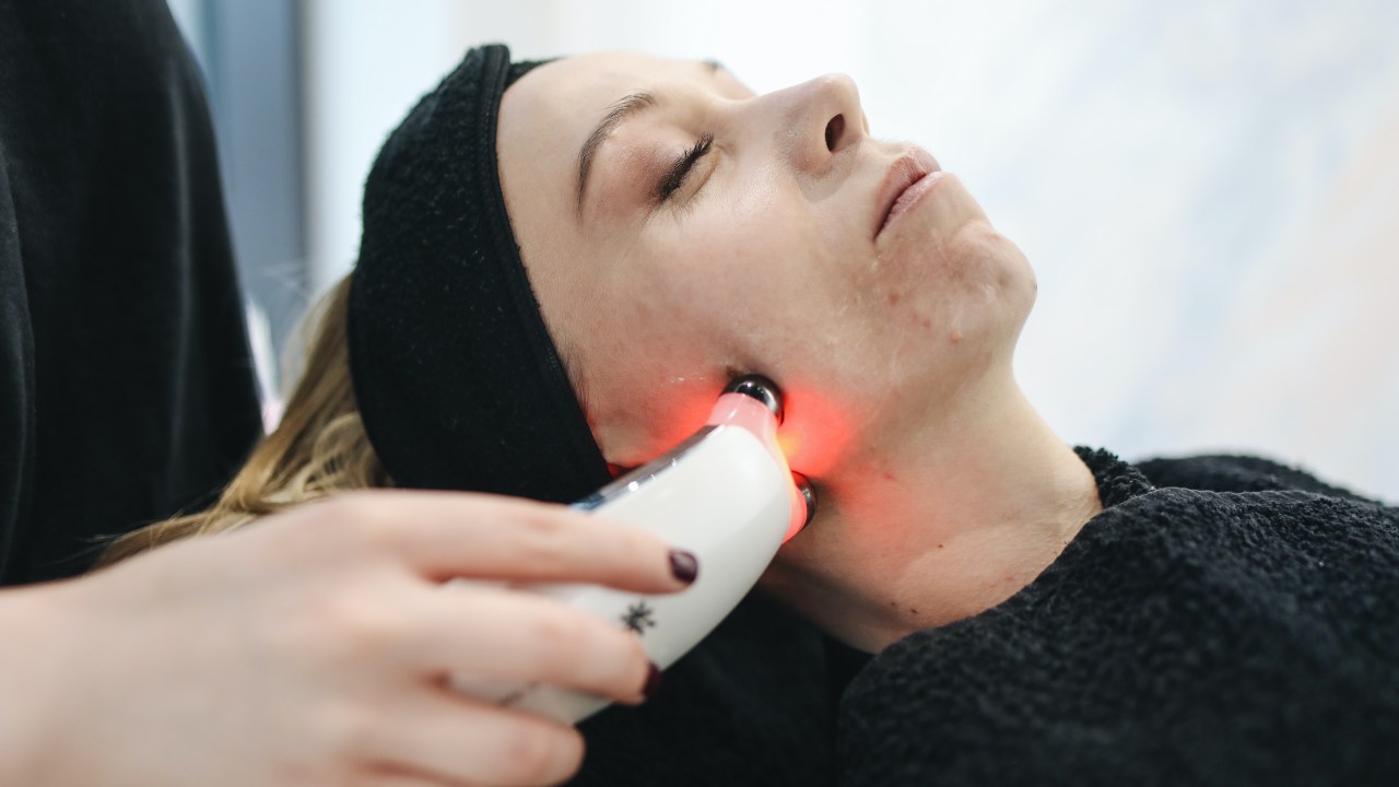 laser facial