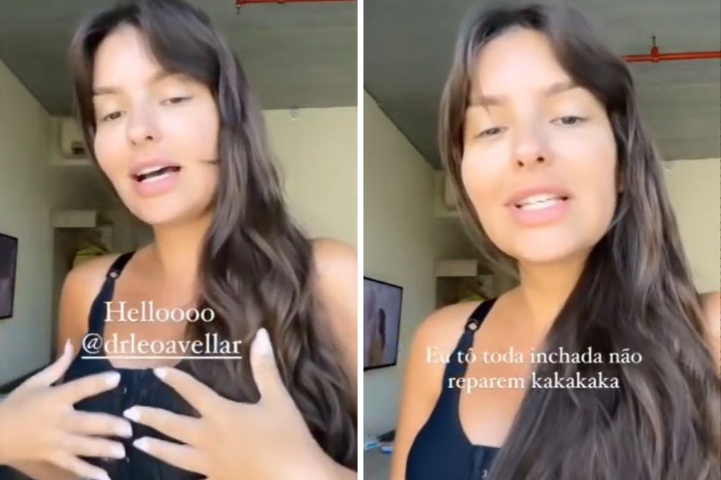 thais braz silicone Thais Braz falando sobre a mastopexia e a redução das próteses de silicone