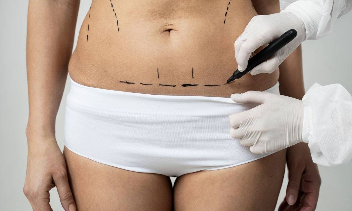 Cirurgia plástica é sempre irreversível?