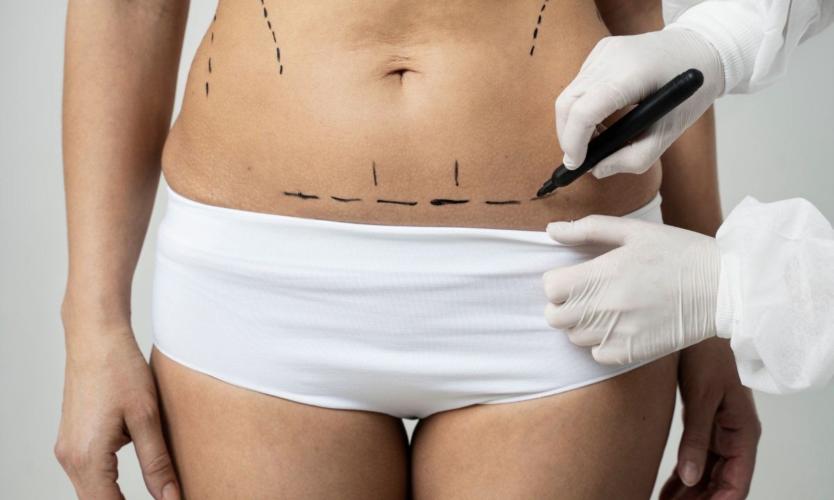 Principais fatos sobre a cirurgia plástica
