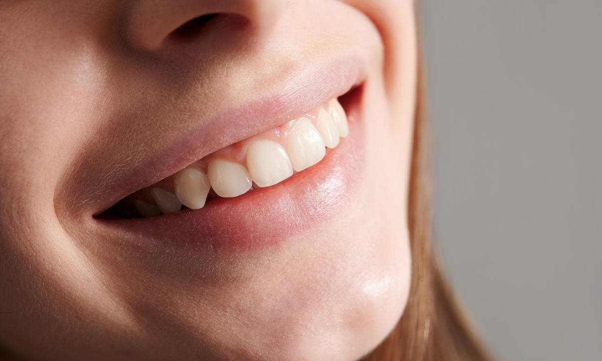Manchas nos dentes