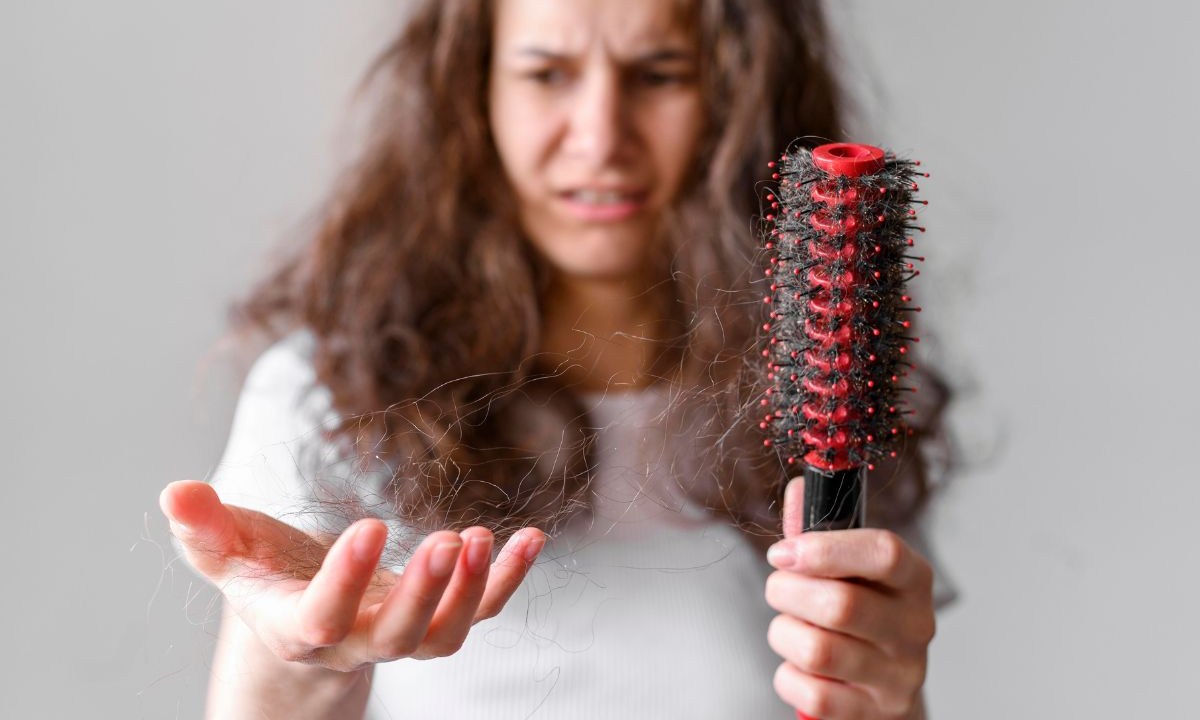 Queda de cabelo pós-parto