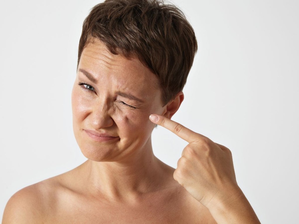 Linhas de expressão e rugas não são a mesma coisa: entenda a diferença