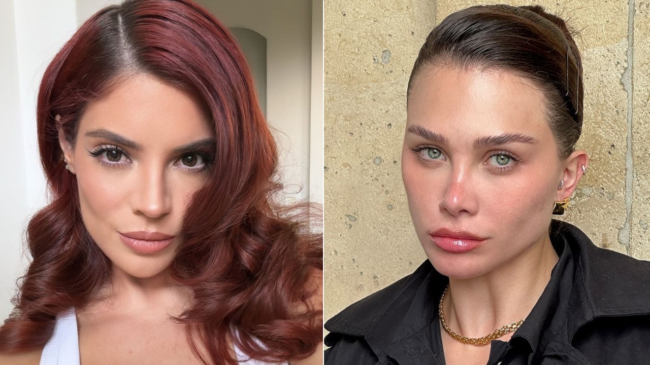 Relembre famosas que optaram por reverter os procedimentos faciais