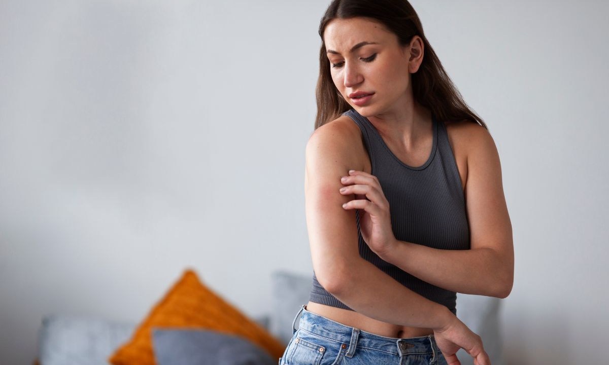 o que é dermatite atópica