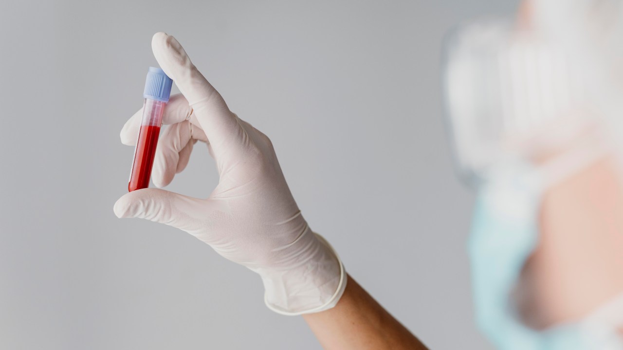 Saiba tudo sobre as células cancerígenas